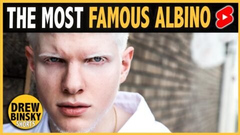 WORLD’S MOST FAMOUS ALBINO